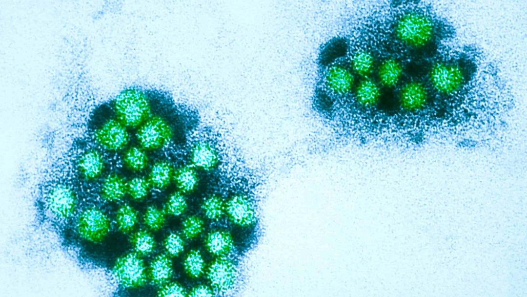 UK Set to Test World's First Norovirus Vaccine